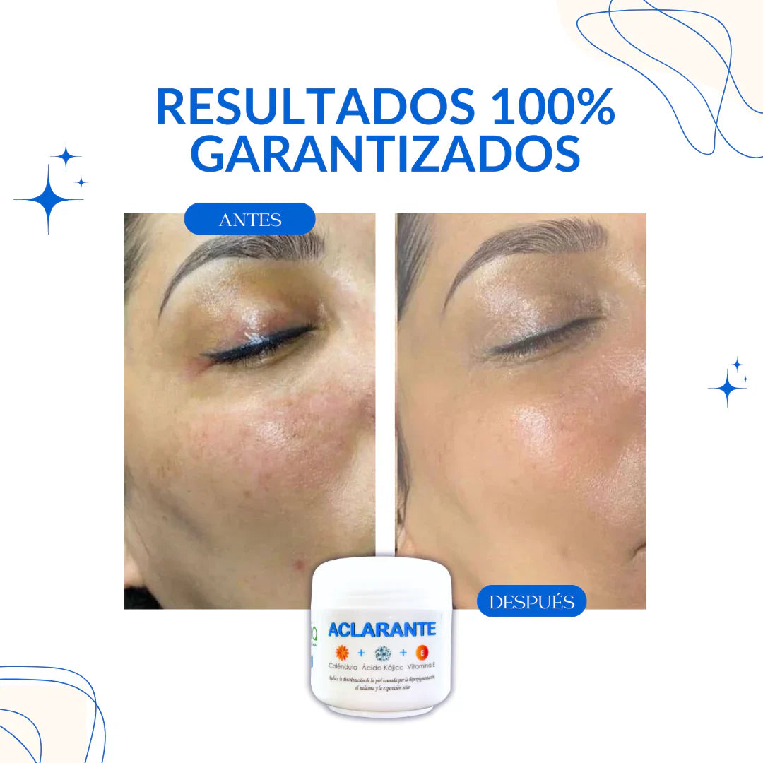 Crema Aclarante Zamia - Resultados 100% Garantizados