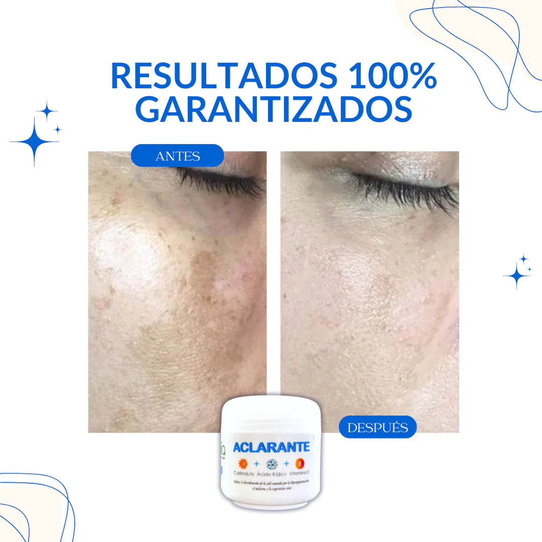 Crema Aclarante Zamia - Resultados 100% Garantizados